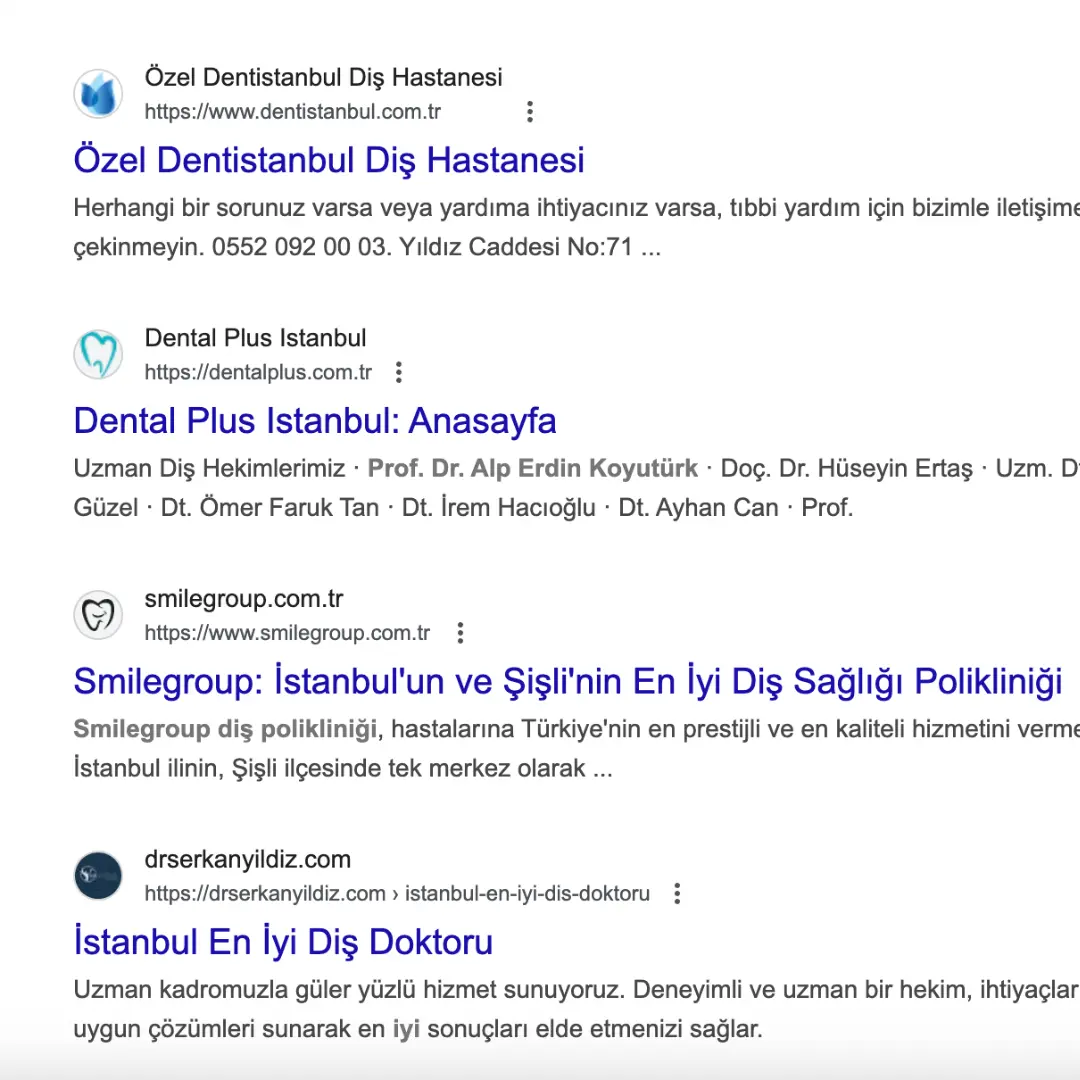 istanbul yerel seo çalışması